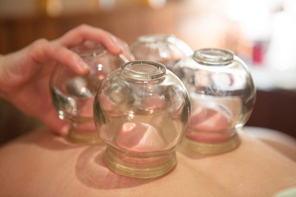 Fire Cupping Massage Therapy